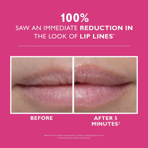 Instant FIRMx Lip Filler|10 ml / 0.3 fl oz