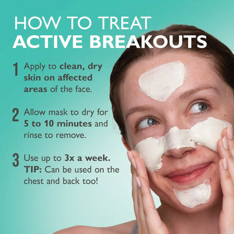 Even Clearer™ Therapeutic Sulfur Mask