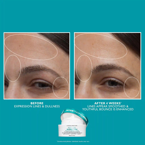 Full-Size Peptide Skinjection™ 2-Piece Kit Face & Eye Kit
