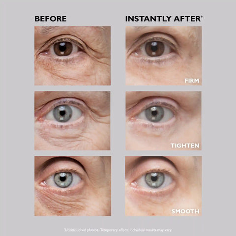 Instant FIRMx Eye Temporary Eye Tightener | 30 ml / 1.0 fl oz