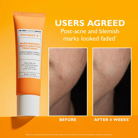 Potent-C Niacinamide Discoloration Treatment | 50 ml/1.7 fl oz